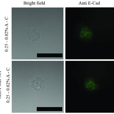 Staining Of E Cadherin In Cellular Spheroids Of MCF 7 And MBA MB 361