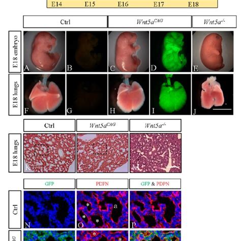 Wnt5a Inactivation Attenuated Saccular Stage Lung Development Top