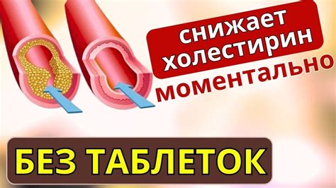 Как ПРОСТО и БЫСТРО снизить Холестерин без Лекарств в домашних условиях ...