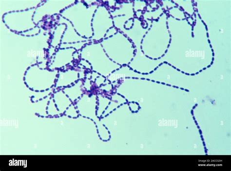 Streptococcus Bacteria Light Micrograph Of Gram Stained Streptococcus