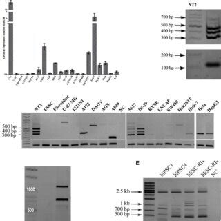 Expression Of Linc ROR And Its Spliced Variants During NT2 Cells