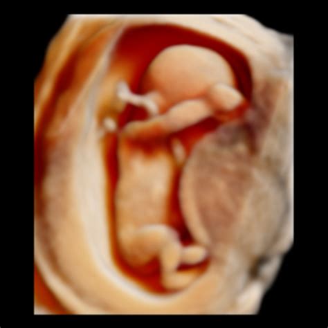 ultrasound 5d , delhi, india | Gallery