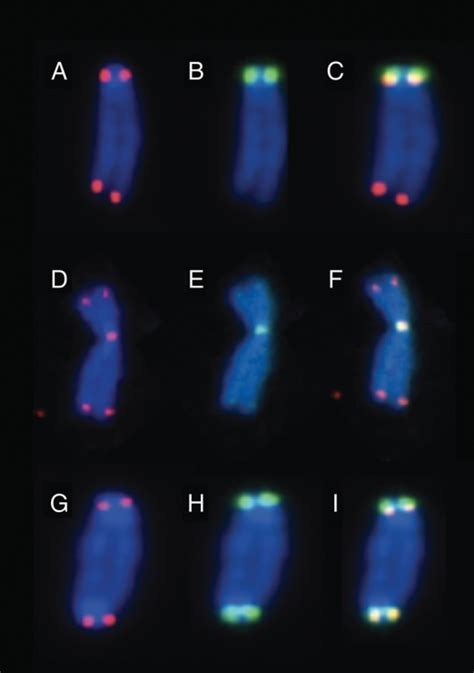 Metaphase Early Passage Of A Mouse Fibroblast Cell Line Open I