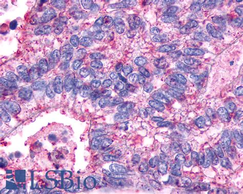 Pathplus Avpr V R Polyclonal Antibody Rabbit Anti Human Ihc Lsbio