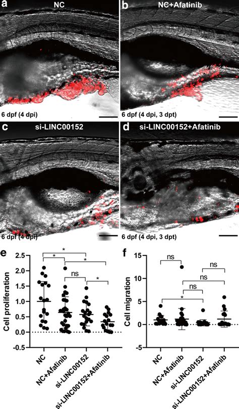 Knockdown Of Linc00152 And Block Of Egfr Have A Synergic Effect Of