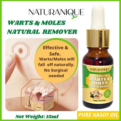 Warts Remover Original Pure Organic Kasoy Oil Legit Effective Natural