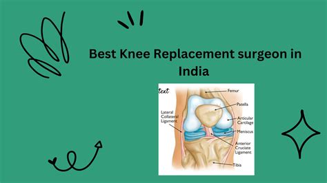 Best Knee Replacement Surgeon In India By Anil Arora Issuu