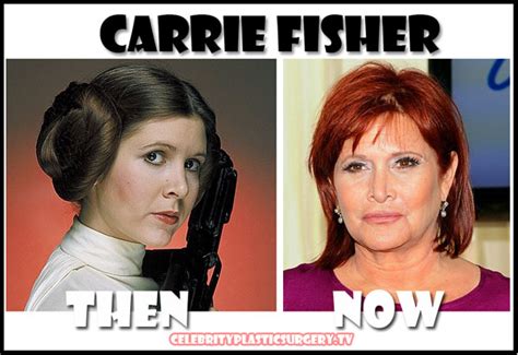 Carrie Fisher Plastic Surgery Before Weight Loss and Facelift - Star ...