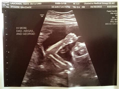 First Comes Love 20 Week Ultrasound