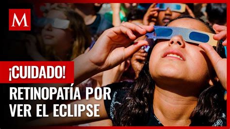 Qué Es La Retinopatía Solar Y Cómo Evitarla En El Eclipse 2023 Youtube