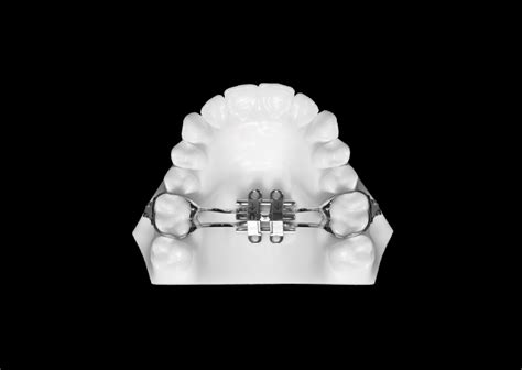MSE - Universal Orthodontic Lab