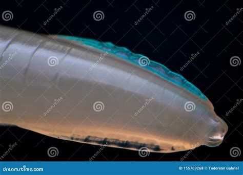 Macro Photo of Adult Toxocara Canis Stock Photo - Image of diagnostics ...