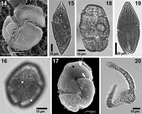 Unarmoured Dinoflagellates Lm And Sem 14 Gyrodinium Metum Cell In