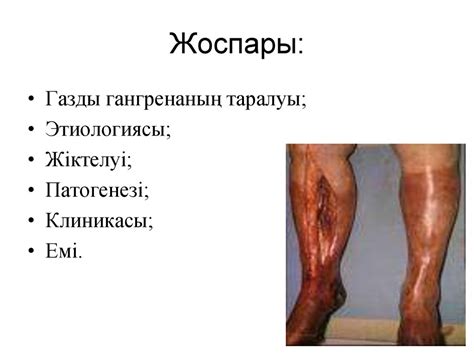 Газды гангрена - презентация онлайн