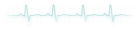 Politica de confidențialitate Ghid de interpretare EKG pentru studenti