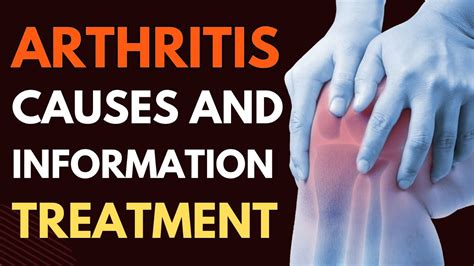 Unlocking The Secrets Of Arthritis Causes And Breakthrough Treatments