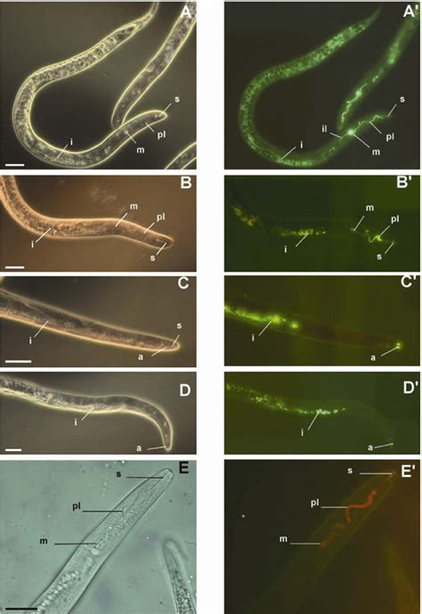 Fluorescence microscopy showing fluorescein isothiocyanate (FITC) and... | Download Scientific ...