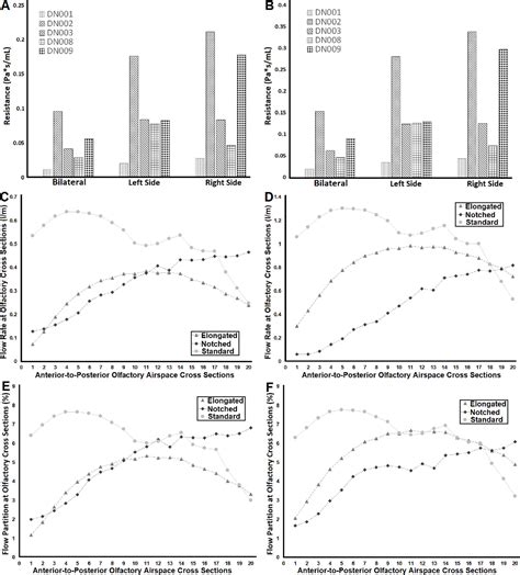 Figure 2 from Role of nasal vestibule morphological variations on ...