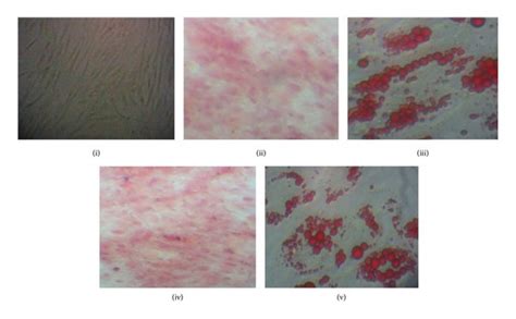 Morphology And Differentiation Ability Of Mscs Isolated From Controls Download Scientific