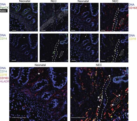 Imc Reveals That Cd16 Cd163 Monocytes Are Adjacent To Blood Vessels