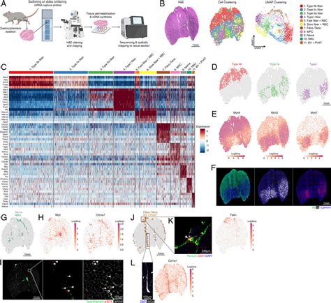 Spatial Transcriptomics Profiling Of Skeletal Muscle Identifies