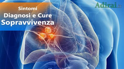 Tumore Ai Polmoni Sintomi Diagnosi Sopravvivenza E Cure