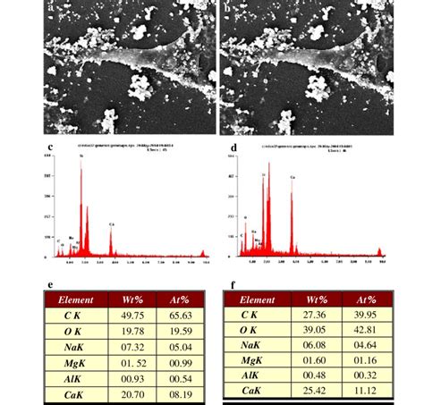 Sem And Edx Analysis For Specimen Treated With Nanophase Hydroxyapatite Download Scientific