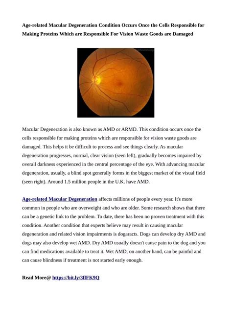 Ppt Age Related Macular Degeneration Pdf Powerpoint Presentation