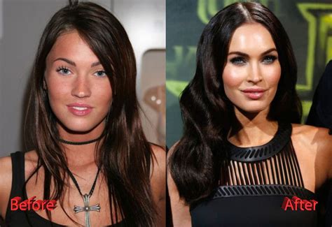 Megan Fox Plastic Surgery Before And After Plastic Surgery Mistakes