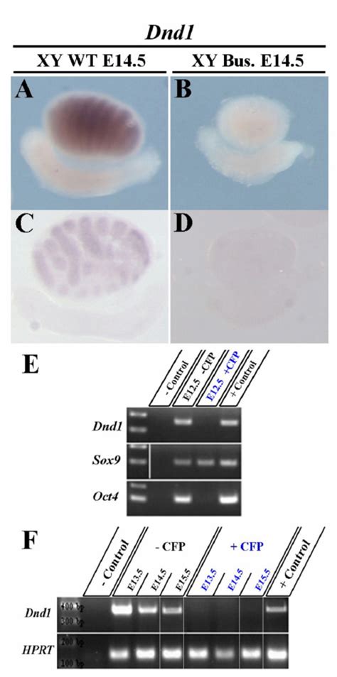 Expression Of Dnd1 Is Restricted To Germ Cells Of The Developing Testis