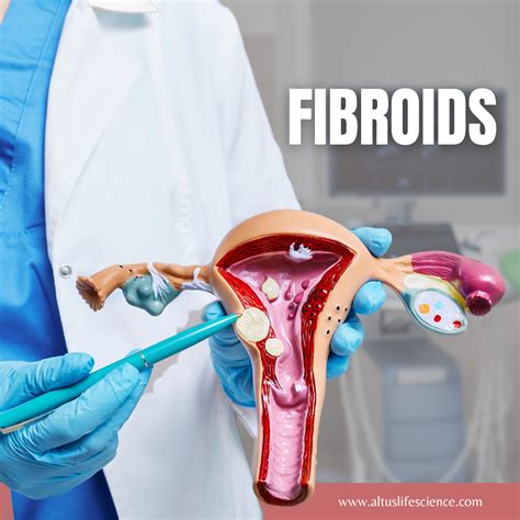 Uterine Fibroids During Pregnancy Symptoms And Treatment Artofit