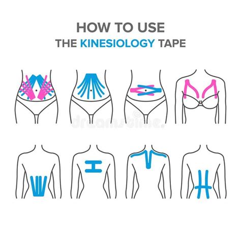 Illustration About How To Use The Kinesio Tape Kinesiology Taping Of