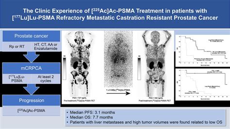 Clinical Experience With Ac Ac Psma Treatment In Patients With