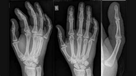 Musculoskeletal Msk X Ray Interpretation Osce Guide Geeky Medics