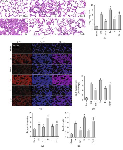 Figure From Postconditioning With Irisin Attenuates Lung Ischemia