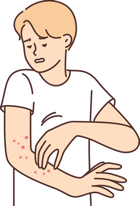 Man With Rash On Arm Suffers From Itching And Eczema Caused By Infection That Affects Skin