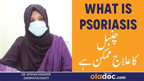 Psoriasis Kya Hai Psoriasis Treatment In Urdu Chambal Ki Bimari Ka