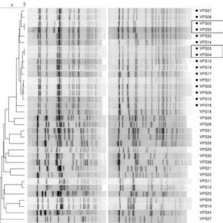 Sfii And Noti Pfge Patterns Of Seven Selected Vibrio Parahaemolyticus