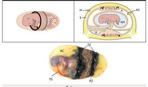 Placenta Gestation Parturition Flashcards Quizlet