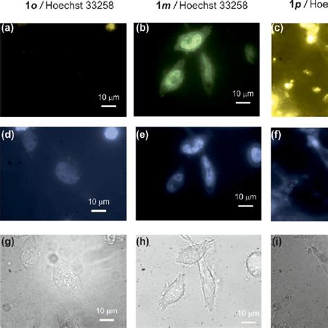 Fluorescence Af And Bright Field Gi Images Of Hela Cells Loaded