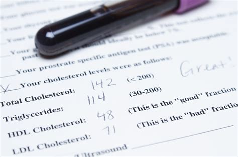 What Is Total Cholesterol and What Does It Mean?
