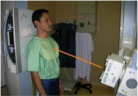 Chest Radiography Flashcards Quizlet