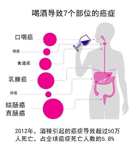 劍橋大學：喝酒破壞dna，增加癌症風險 中國人最受傷 每日頭條