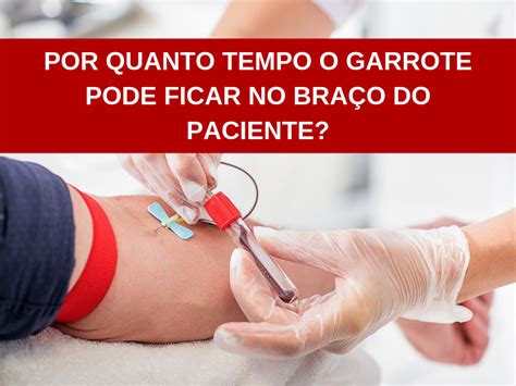 Por Quanto Tempo O Garrote Pode Ficar No Bra O Do Paciente Tira O Jaleco