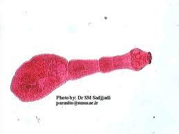 Echinococcus Granulosus-Life cycle-Habitat and Transmission | MedicoTips.Com