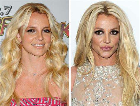 La Razón Detrás Del Revuelo Por El Cambio Facial De Britney Spears Genial