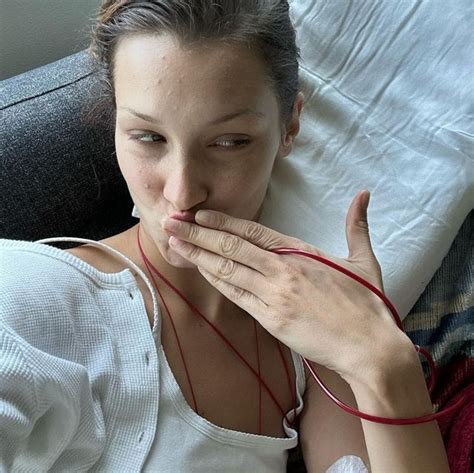 「萊姆病」是什麼？症狀會好嗎？bella Hadid、小賈斯汀和艾薇兒都曾因此消失