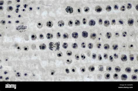 Mitosis Under Microscope Labeled