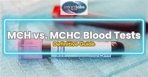 Mch Mchc Blood Tests Everything To Know