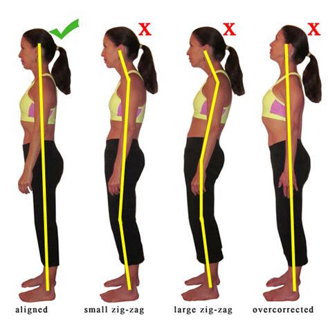 Postural Correction And Alignment Therapy In Toronto